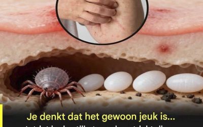 Allergie of schurft: hoe je het verschil kunt zien en waarom ze niet hetzelfde zijn.