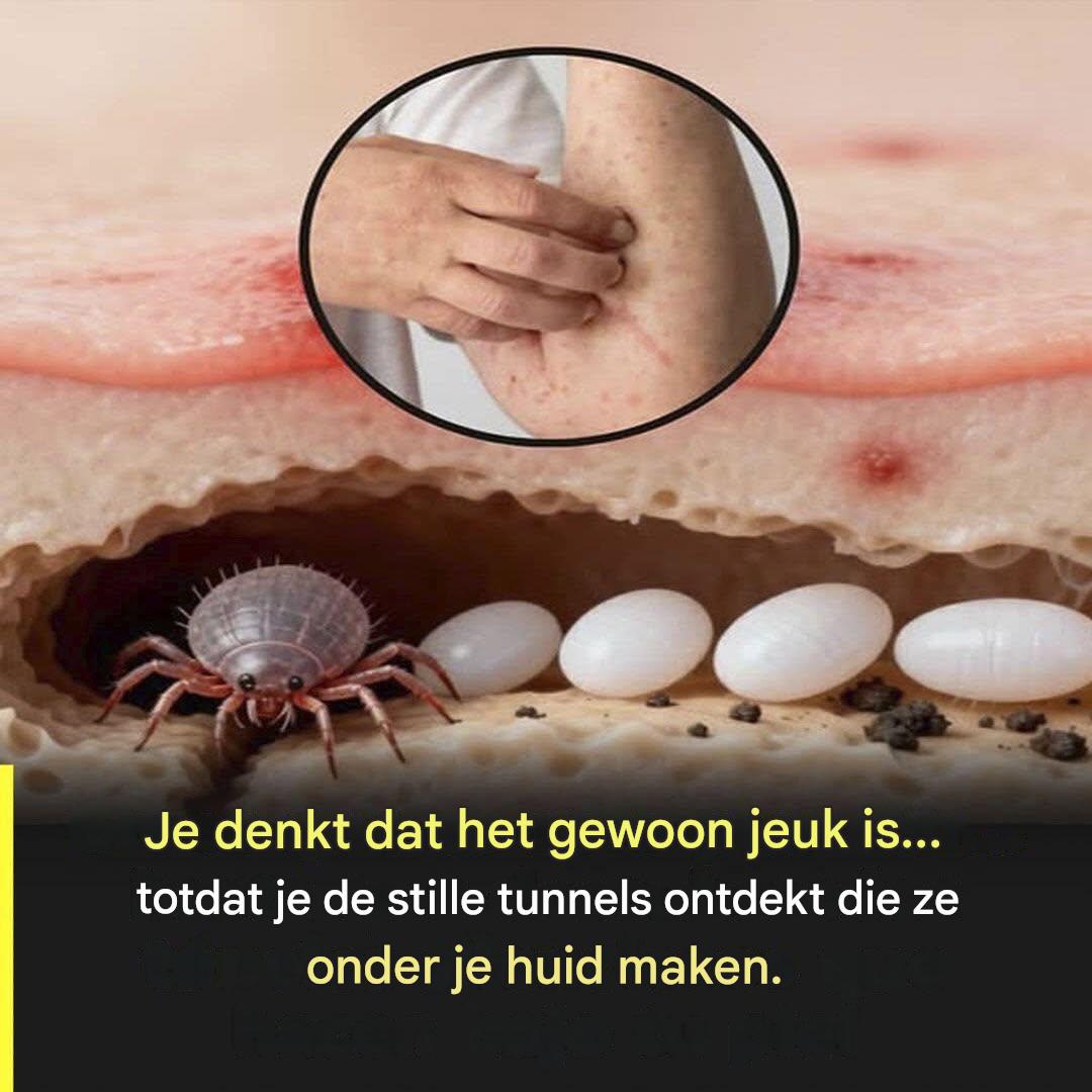 Allergie of schurft: hoe je het verschil kunt zien en waarom ze niet hetzelfde zijn.