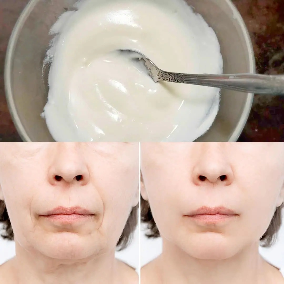 Zuiveringszout: de natuurlijke crème die rimpels en oneffenheden in het gezicht laat verdwijnen.
