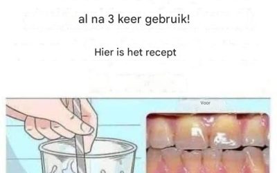 Verwijder tandplak en maak je tanden witter met dit eenvoudige recept.