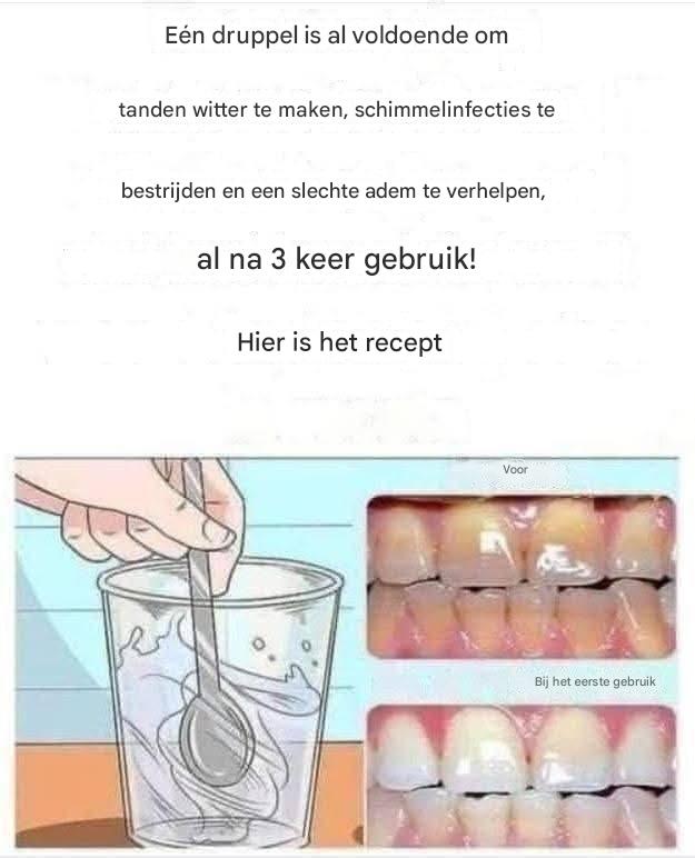 Verwijder tandplak en maak je tanden witter met dit eenvoudige recept.