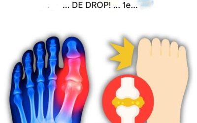 “Mijn grote teen stond in brand… Totdat ik deze 5 drankjes ontdekte die urinezuur op natuurlijke wijze elimineren!”