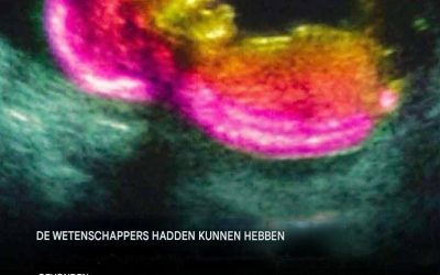 Wetenschappers hebben mogelijk een van de oorzaken van autisme ontdekt.