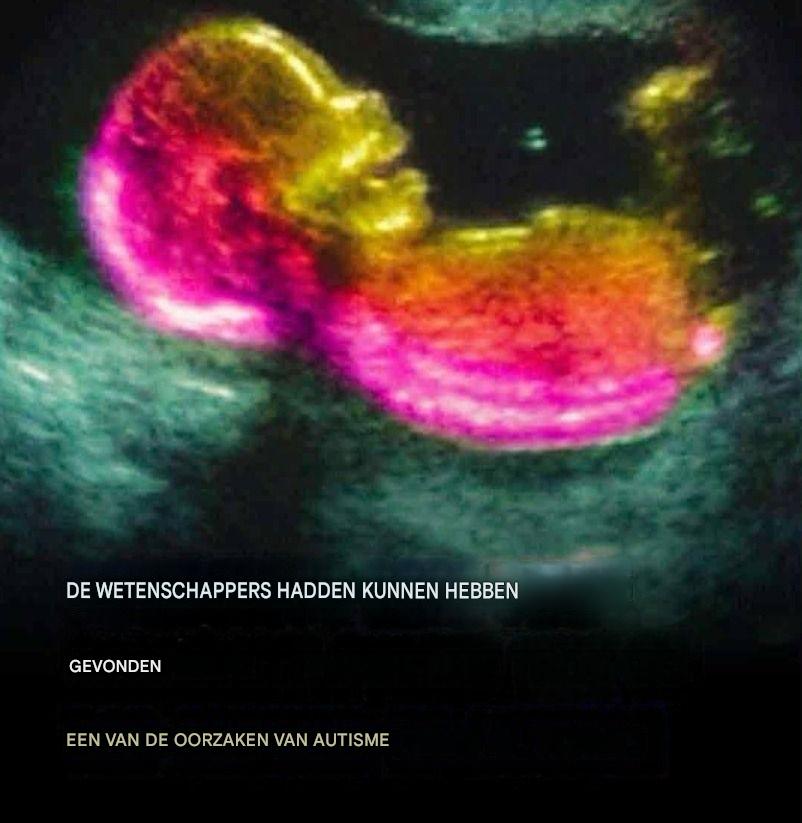 Wetenschappers hebben mogelijk een van de oorzaken van autisme ontdekt.