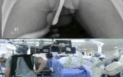 Niemand had het verwacht… een onschuldige kwaal mondde uit in een medisch noodgeval en liet een duidelijke waarschuwing achter.