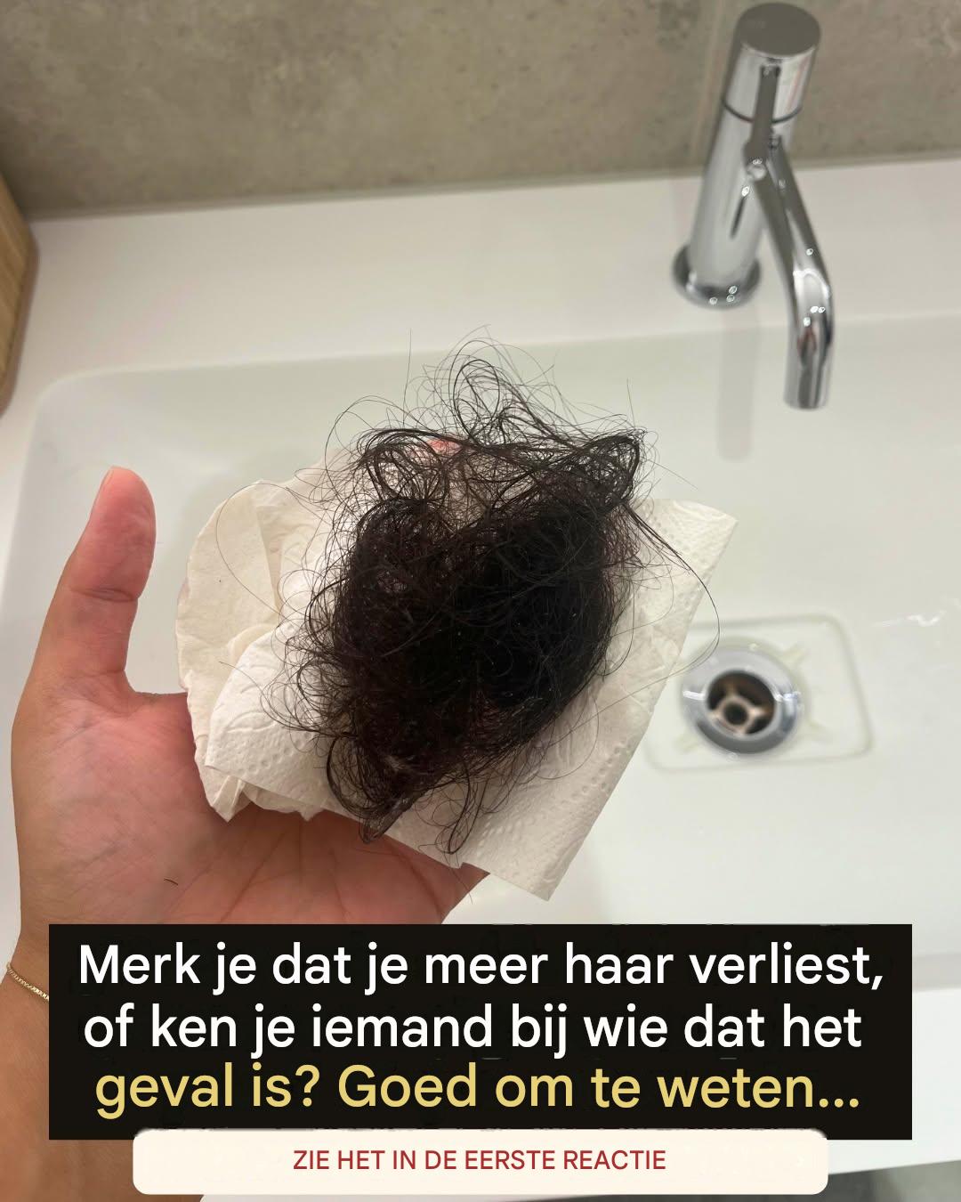 Wist je dat haaruitval een symptoom kan zijn van… Lees meer