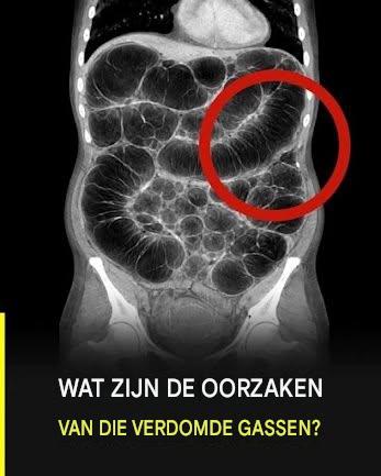Veelvoorkomende darmgassen: de werkelijke oorzaken die bijna niemand duidelijk uitlegt.