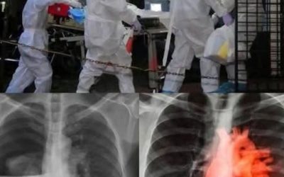 Waarschuwing: COVID-19-gevaccineerde kinderen kunnen besmet zijn… Lees meer