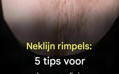 Rimpels op het decolleté: 5 tips om ze te voorkomen en te verwijderen