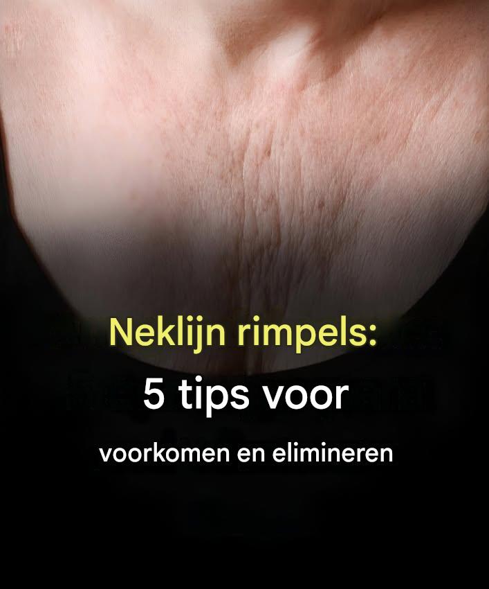 Rimpels op het decolleté: 5 tips om ze te voorkomen en te verwijderen