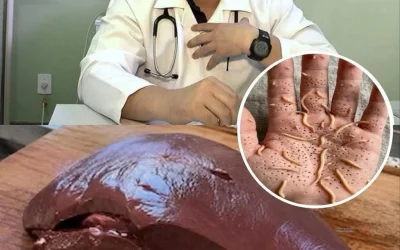 Artsen onthullen dat het eten van runderlever mogelijk de volgende gevolgen kan hebben… Lees meer