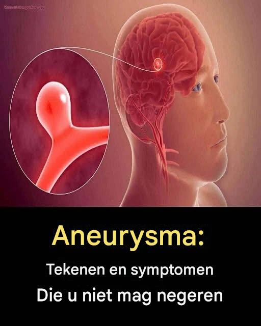 12 waarschuwingssignalen die kunnen wijzen op een hersenaneurysma – negeer deze rode vlaggen niet