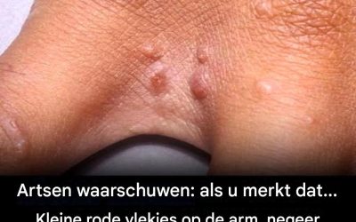 Rode vlekken op de huid en intense jeuk? Ontdek deze veelvoorkomende en vaak onbegrepen aandoening