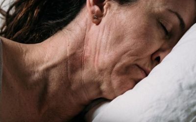 Aneurysma van de interne halsader: waarom treedt het vaak ‘s nachts op?