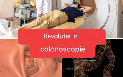 Nieuwe methode: colonoscopie is niet langer een invasief onderzoek. (1/2)