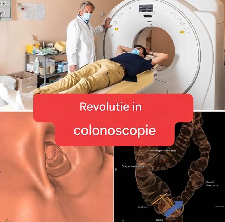 Nieuwe methode: colonoscopie is niet langer een invasief onderzoek. (1/2)