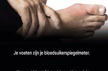 Hier zijn vijf ongebruikelijke voetsymptomen.