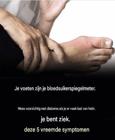 Hier zijn vijf ongebruikelijke voetsymptomen.