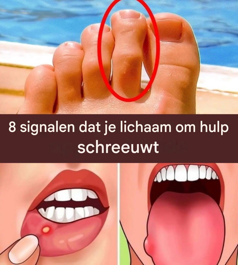 8 signalen dat je lichaam om hulp schreeuwt