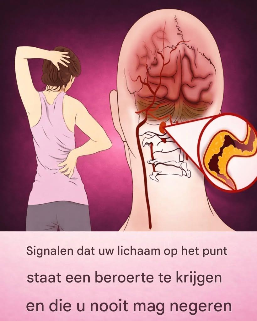 10 vroege waarschuwingssignalen van een beroerte die iedereen moet kennen om direct actie te kunnen ondernemen.