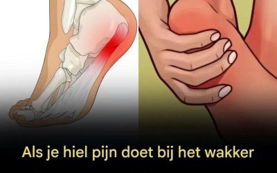 7 krachtige oefeningen om hielpijn te verlichten en plantaire fasciitis op natuurlijke wijze te behandelen