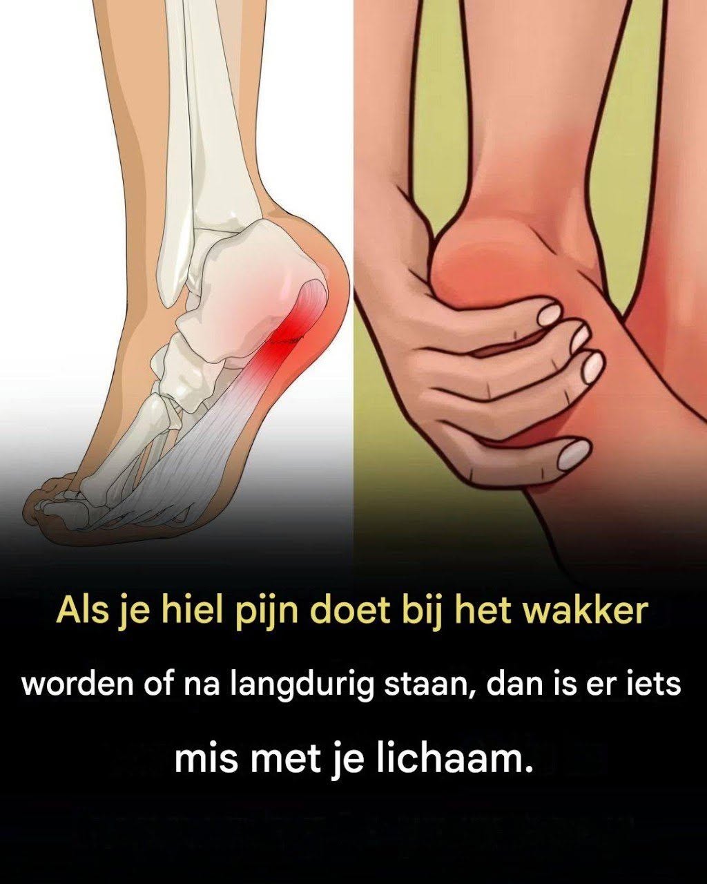 7 krachtige oefeningen om hielpijn te verlichten en plantaire fasciitis op natuurlijke wijze te behandelen
