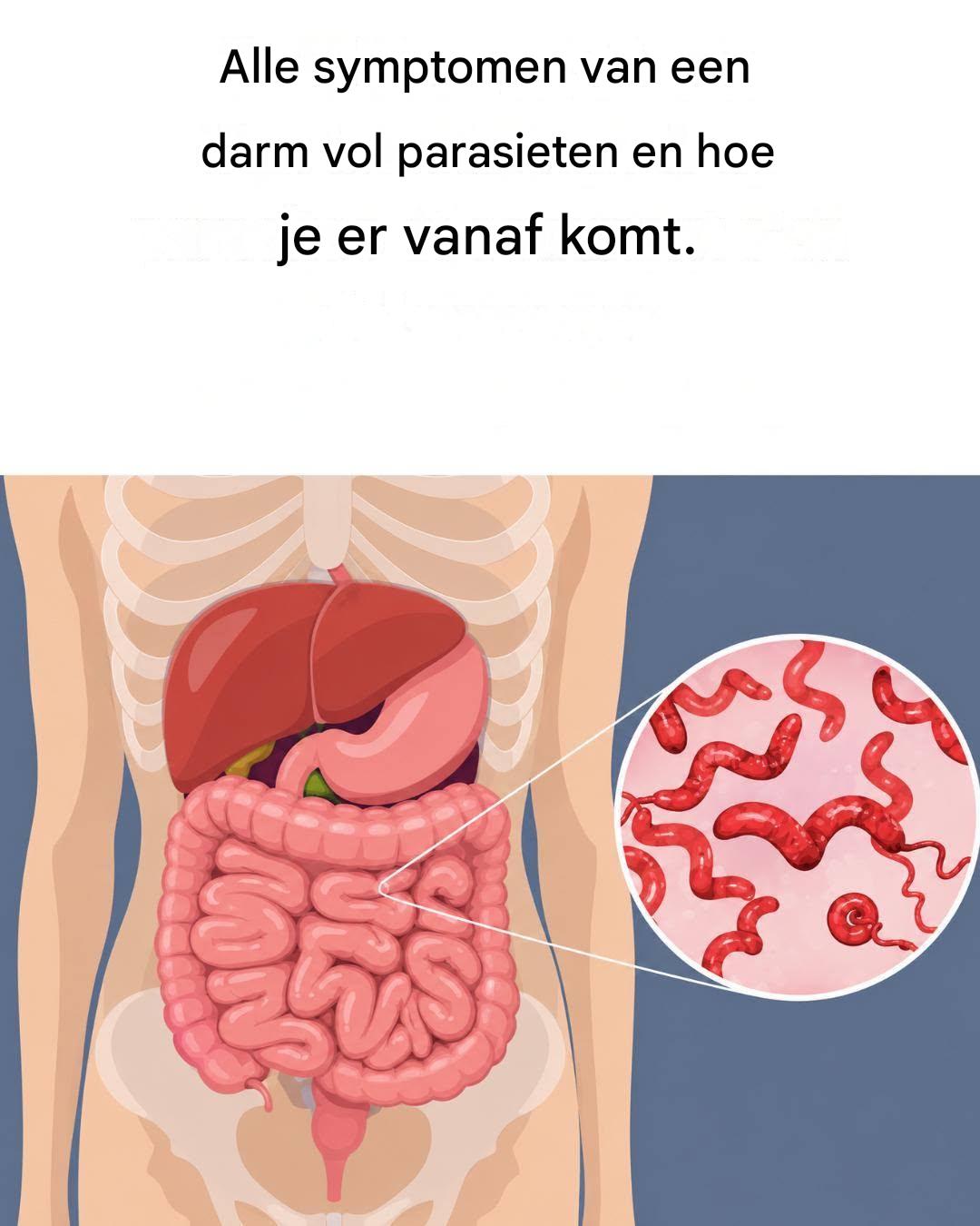 Alle symptomen van een door parasieten geïnfecteerde darm en wat u kunt doen om het te verhelpen.