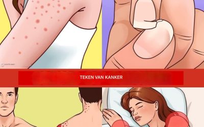 12 waarschuwingssignalen dat er kankercellen in je lichaam aan het groeien zijn.