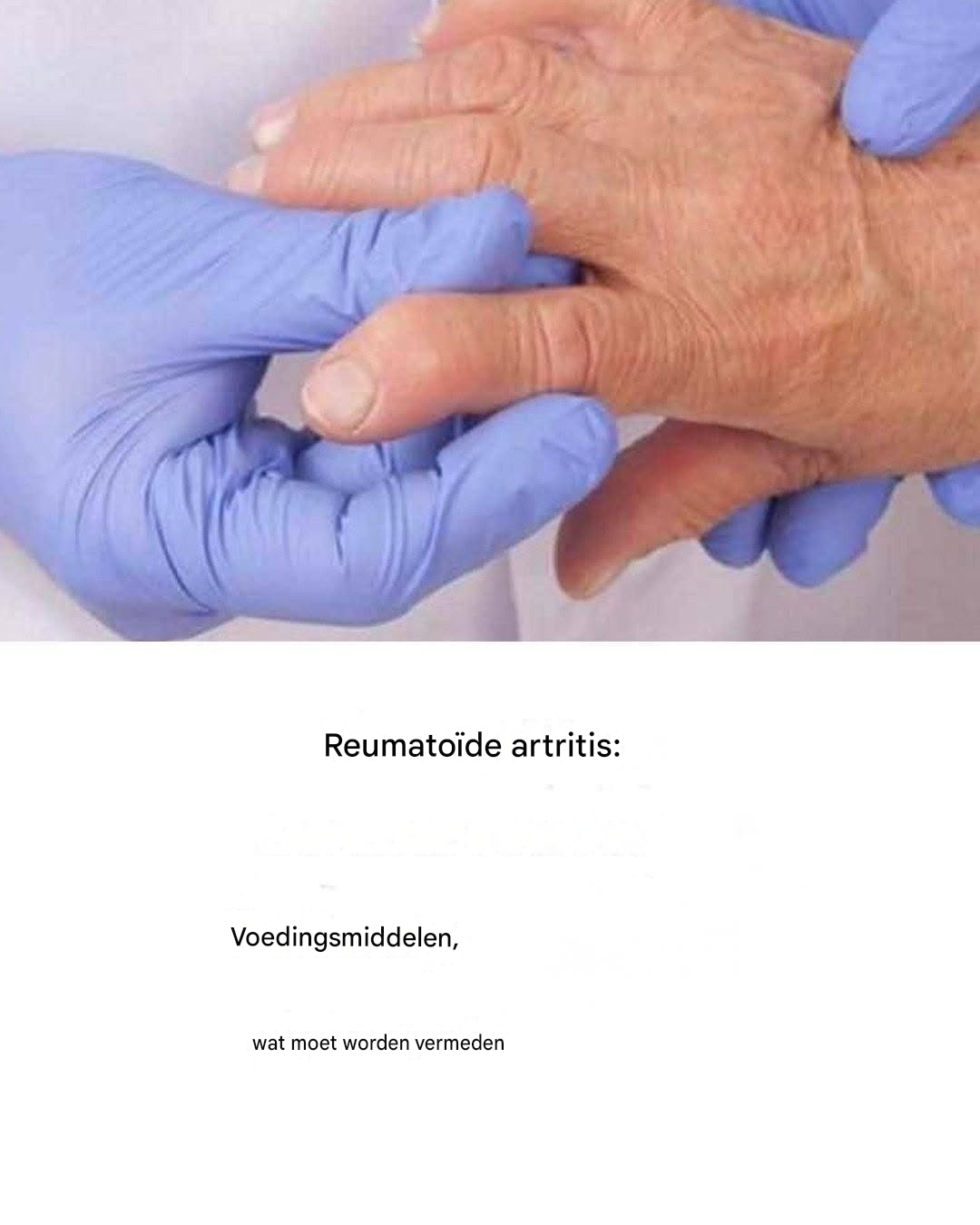 Leven met reumatoïde artritis: dagelijkse uitdagingen