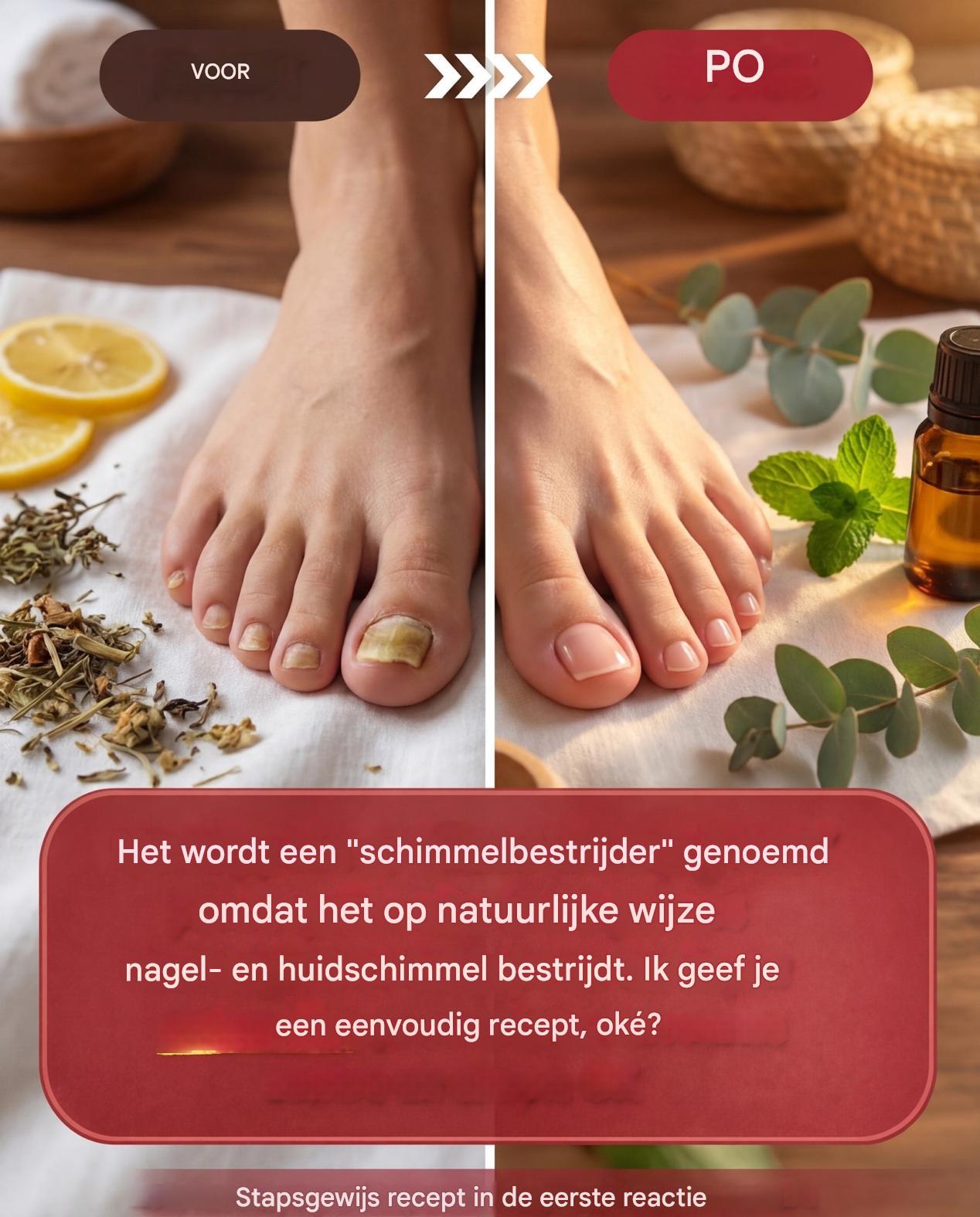 Kruidnagels vallen op door hun krachtige schimmelwerende, antibacteriële en helende eigenschappen. In combinatie met andere natuurlijke ingrediënten zoals kokosolie, knoflook of appelazijn vormen ze een krachtig wapen in de strijd tegen hardnekkige schimmelinfecties. In dit artikel vind je gedetailleerde recepten, instructies, voordelen en voorzorgsmaatregelen, gebaseerd op traditionele methoden die hun waarde hebben bewezen.
