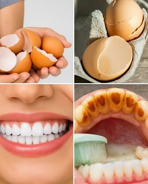 Verfraai je glimlach op natuurlijke wijze met ingrediënten uit de keuken.