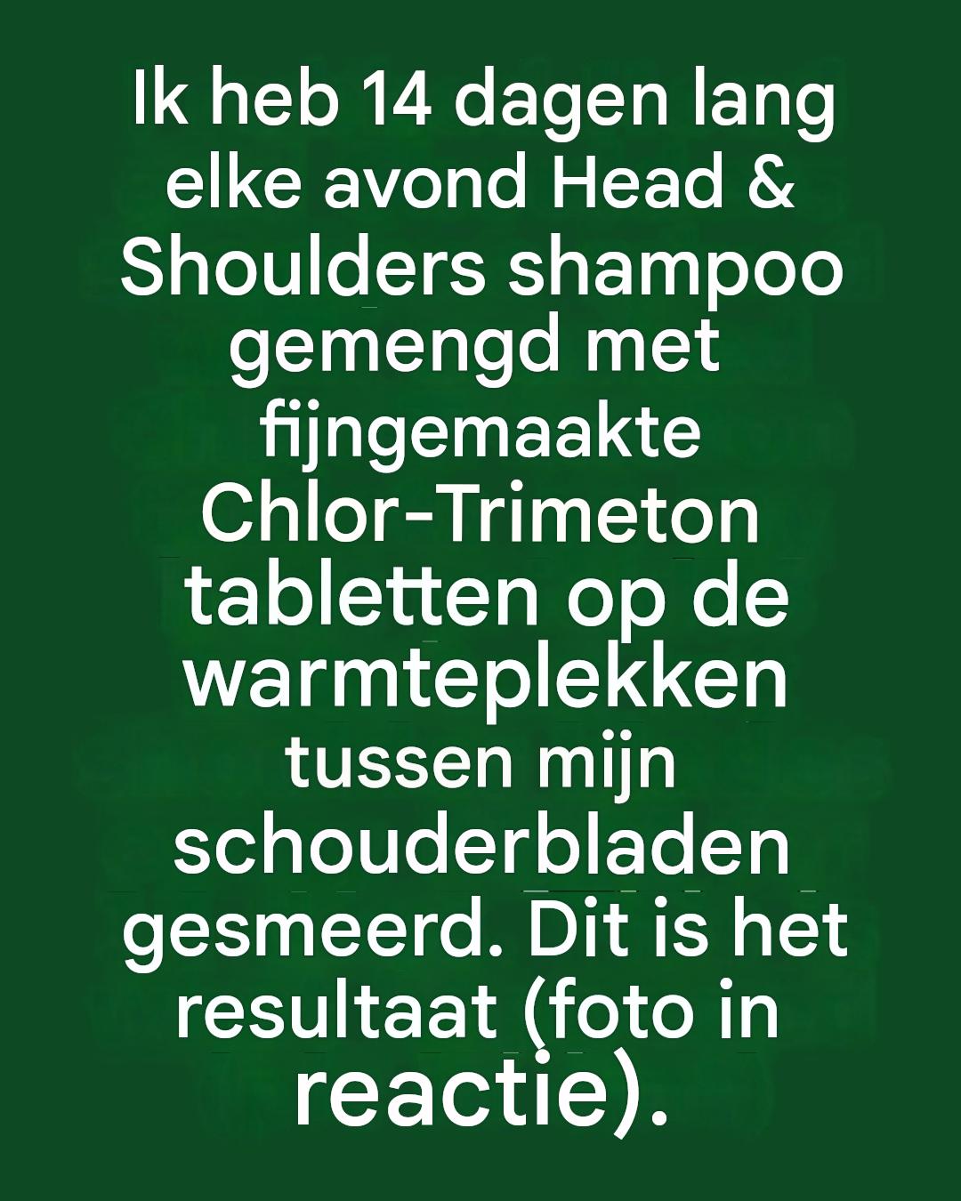 Ik heb 14 dagen lang elke avond Head & Shoulders shampoo gemengd met fijngemaakte Chlor-Trimeton tabletten op de warmteplekken tussen mijn schouderbladen gesmeerd. Dit is wat er gebeurde.