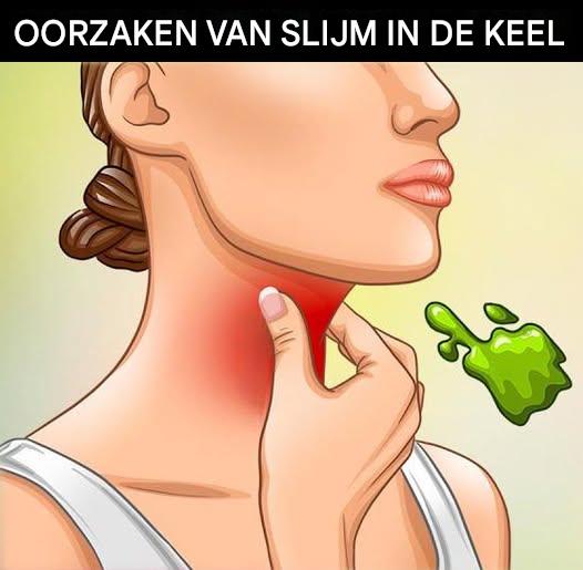 De werkelijke oorzaken van aanhoudend slijm in de keel en hoe je er vanaf komt.
