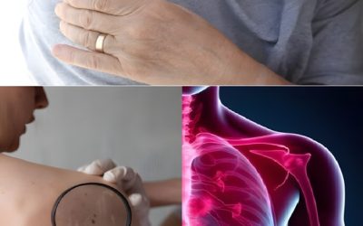 16 vroege tekenen dat er kanker in je lichaam aan het ontstaan ​​is.