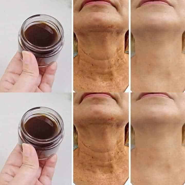Tips voor een stralende huid zonder chemicaliën