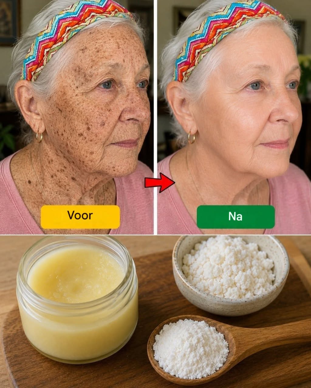 Hoe vaseline een verzachtend effect heeft op huidafwijkingen. HYN