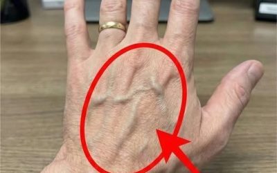 Als je zichtbare aderen hebt, betekent dit dat je… Lees meerAls je zichtbare aderen hebt, betekent dit dat je… Lees meer