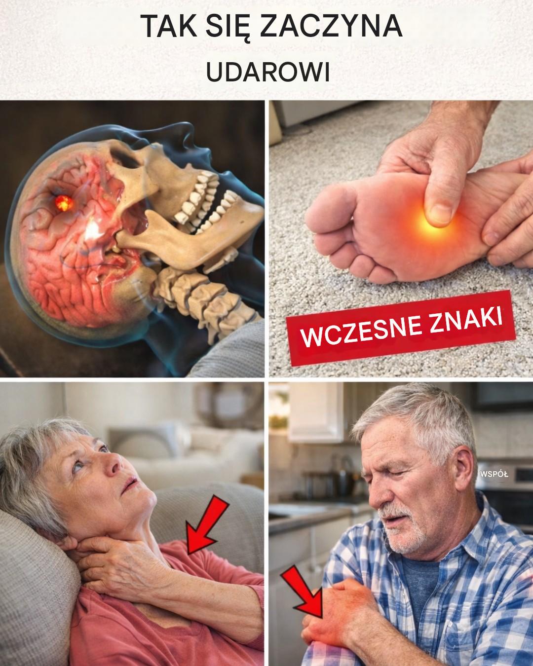8 waarschuwingssignalen voor een beroerte een maand van tevoren (en 9 effectieve tips om het te voorkomen)