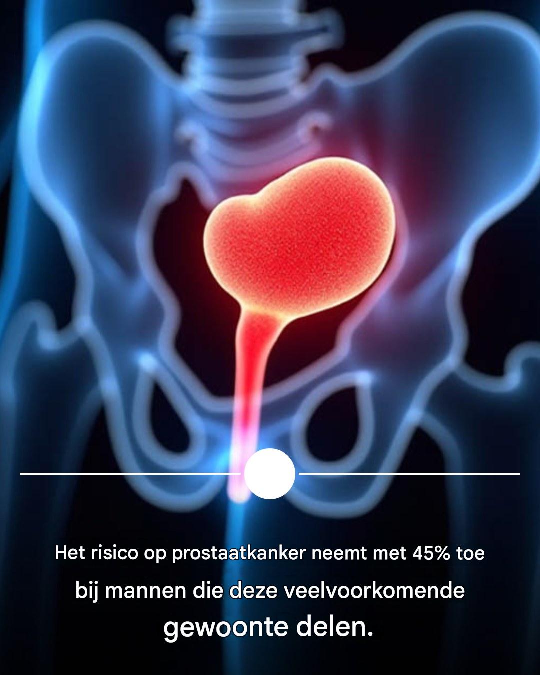 Mannen die deze cruciale praktijk verwaarlozen, lopen 45% meer risico op prostaatkanker.