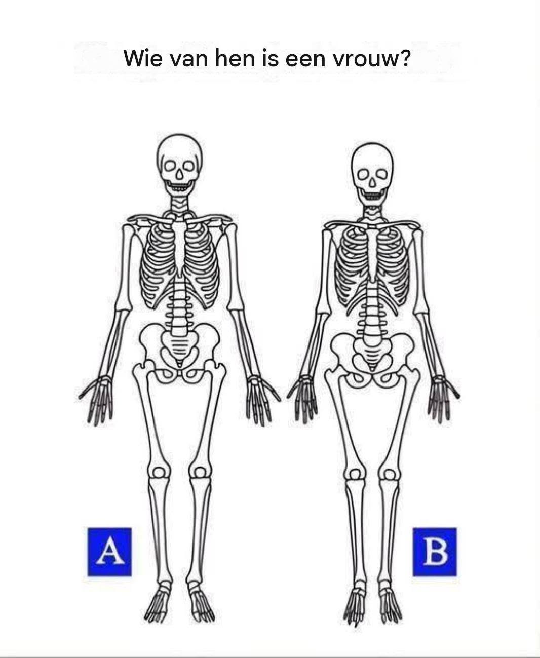 Slechts 1 op de 10 mensen kan herkennen welk skelet van een vrouw is… Kun jij dat?🦴